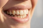 Brasssmile