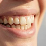 Brasssmile