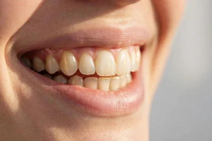 Brasssmile
